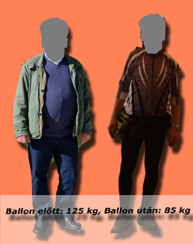 lajos_gyomorballon_tortenete